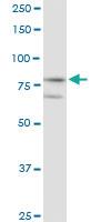 Anti-KLHL4 Rabbit Polyclonal Antibody