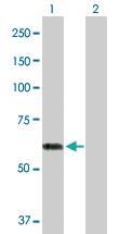 Anti-ACCS Rabbit Polyclonal Antibody