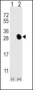 Anti-Osteocalcin Rabbit Polyclonal Antibody (AP (Alkaline Phosphatase))