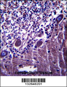 Anti-PLXNC1 Rabbit Polyclonal Antibody (FITC (Fluorescein Isothiocyanate))