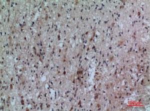 Immunohistochemical analysis of paraffin-embedded human brain using Anti-FCRL5 Antibody