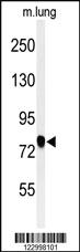 Anti-SEMA3C Rabbit Polyclonal Antibody