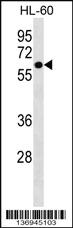 Anti-ZNF649 Rabbit Polyclonal Antibody