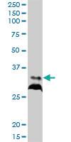 Anti-RPIA Mouse Polyclonal Antibody