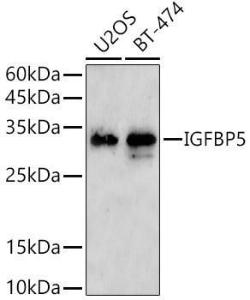 Western blot analysis of extracts of various cell lines, using Anti-IGFBP5 Antibody (A306585) at 1:1000 dilution