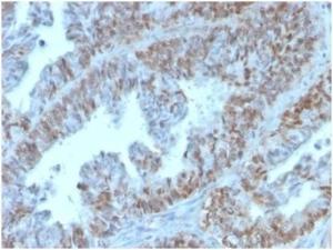 Immunohistochemical analysis of formalin-fixed, paraffin-embedded human colon tissue using Anti-PAX2 Antibody [PAX2/1105]