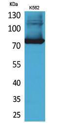 Western blot analysis of K562 cells using Anti-TF Antibody