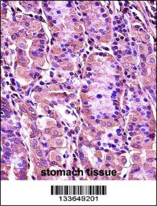 Anti-SYT1 Rabbit Polyclonal Antibody (HRP (Horseradish Peroxidase))