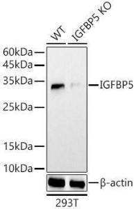 Western blot analysis of extracts from wild type (WT) and IGFBP5 knockout (KO) 293T cells, using Anti-IGFBP5 Antibody (A306585) at 1:1000 dilution