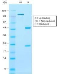 SDS-PAGE analysis of Anti-Calponin 1 Antibody [rCNN1/832] under non-reduced and reduced conditions; showing intact IgG and intact heavy and light chains, respectively. SDS-PAGE analysis confirms the integrity and purity of the antibody.