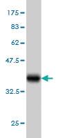 Anti-ARMCX3 Mouse Monoclonal Antibody [clone: 2G3]