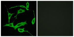 Immunofluorescence analysis of LOVO cells using Anti-GPR85 Antibody. The right hand panel represents a negative control, where the antibody was pre-incubated with the immunising peptide