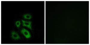 Immunofluorescence analysis of A549 cells using Anti-CLIP3 Antibody. The right hand panel represents a negative control, where the antibody was pre-incubated with the immunising peptide