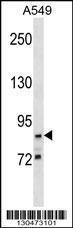 Anti-G2E3 Rabbit Polyclonal Antibody (AP (Alkaline Phosphatase))