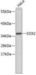 Western blot analysis of extracts of HeLa cells, using Anti-SOX2 Antibody (A11928). The secondary antibody was Goat Anti-Rabbit IgG H&L Antibody (HRP) at 1:10,000 dilution. Lysates/proteins were present at 25µg per lane. The blocking buffer used was 3% non-fat dry milk in TBST.