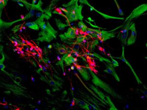 Mixed neuron and glia cultures stained with Anti-MAP2 Antibody (red) and Anti-Vimentin Antibody (A85421 / green) and DNA (blue). Anti-MAP2 Antibody reveals strong cytoplasmic staining of dendrites and perikarya of neuronal cells, while vimentin was visualized in astrocytes and fibroblasts.