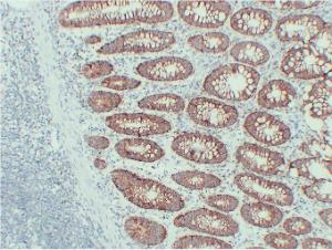 Antibody anti-epcam ABT-epcam 100 µl