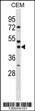 Anti-SSBP3 Rabbit Polyclonal Antibody