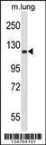 Anti-EPHA2 Rabbit Polyclonal Antibody (HRP (Horseradish Peroxidase))