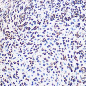 Immunohistochemistry analysis of paraffin-embedded mouse embryos using Anti-SOX2 Antibody (A11928) at a dilution of 1:100 (40x lens). Perform microwave antigen retrieval with 10 mM Tris/EDTA buffer pH 9.0 before commencing with IHC staining protocol.