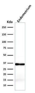 Western blot analysis of endometrium lysate using Anti-Calponin 1 Antibody [rCNN1/832]