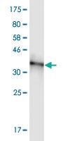 Anti-RBM5 Mouse Monoclonal Antibody [clone: 3G6]