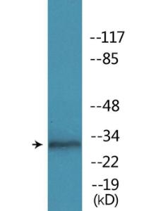 Western blot analysis of lysates from K562 cells treated with EGF 200ng/ml 30' using Anti-MARCKS (phospho Ser158) Antibody