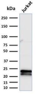 Western blot analysis of Jurkat cell lysate using Anti-CD3 epsilon Antibody [C3e/2479]