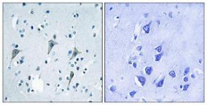 Immunohistochemical analysis of paraffin-embedded human brain tissue using Anti-GPR85 Antibody. The right hand panel represents a negative control, where the antibody was pre-incubated with the immunising peptide