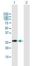 Anti-RPIA Mouse Polyclonal Antibody