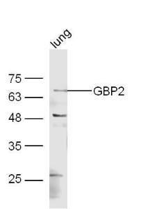 Anti-GBP2 Rabbit Polyclonal Antibody