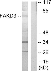 Western blot analysis of lysates from HepG2 cells using Anti-FAKD3 Antibody The right hand lane represents a negative control, where the antibody is blocked by the immunising peptide