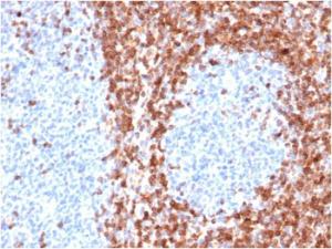 Immunohistochemical analysis of formalin-fixed, paraffin-embedded human tonsil using Anti-Bcl-2 Antibody [BCL2/6426R]