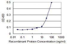 Anti-KLHL4 Mouse Monoclonal Antibody [clone: 4B6]