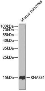 Western blot analysis of extracts of mouse pancreas, using Anti-RNASE1 Antibody (A11933) at 1:1000 dilution. The secondary Antibody was Goat Anti-Rabbit IgG H&L Antibody (HRP) at 1:10000 dilution. Lysates/proteins were present at 25 µg per lane