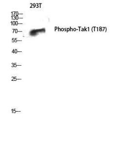 Western blot analysis of 293T cells using Anti-MAP3K7 (phospho Thr187) Antibody