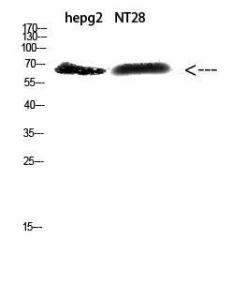 Western blot analysis of hepg NT28 cells using Anti-ZFP91 Antibody