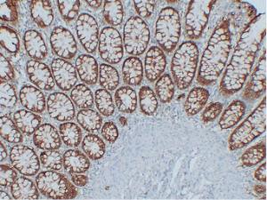 Antibody anti-epcam ABT-epcam 100 µl