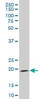 Anti-IHH Mouse Monoclonal Antibody [clone: 2G9]