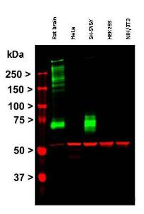 Western blot of Rat whole brain extract, Hela, SH-SY5Y, HEK293, and NIH/3T3 cells probed with Anti-MAP2 Antibody (green). All forms of MAP2 are present in the rat brain homogenate. A band at ~280 kDa corresponds to full length intact MAP2A/2B.