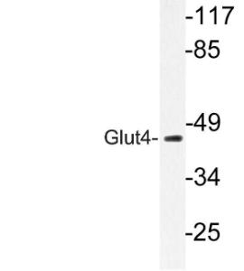 Anti-Glut4 antibody