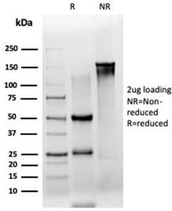 Anti-ZSCAN2 antibody