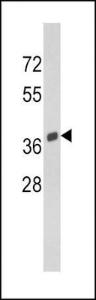 Anti-Osteonectin Rabbit Polyclonal Antibody