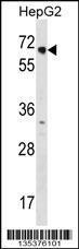 Anti-NR2C1 Rabbit Polyclonal Antibody