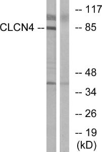 Western blot analysis of lysates from MCF-7 cells using Anti-CLCN4 Antibody The right hand lane represents a negative control, where the antibody is blocked by the immunising peptide