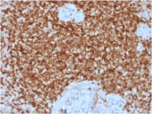 Immunohistochemical analysis of formalin-fixed, paraffin-embedded human spleen using Anti-Bcl-2 Antibody [BCL2/1878R]