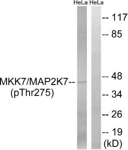 Western blot analysis of lysates from HeLa cells treated with calyculin A 50ng/ml 30' using Anti-MAP2K7 (phospho Thr275) Antibody. The right hand lane represents a negative control, where the antibody is blocked by the immunising peptide.