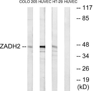 Anti-ZADH2 Rabbit Polyclonal Antibody