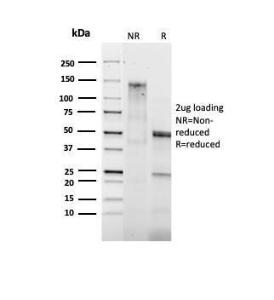 SDS-PAGE analysis of Anti-Bcl-2 Antibody [BCL2/1878R] under non-reduced and reduced conditions; showing intact IgG and intact heavy and light chains, respectively SDS-PAGE analysis confirms the integrity and purity of the antibody