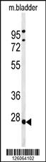 Anti-TPRGL Rabbit Polyclonal Antibody